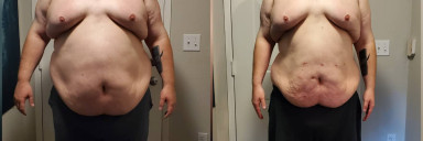 104 lbs Weight Loss 6'3 Male 477 lbs to 373 lbs