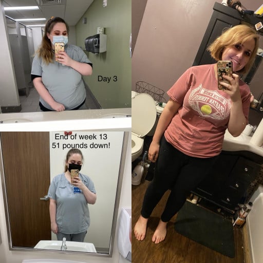 A before and after photo of a 5'7" female showing a weight reduction from 286 pounds to 194 pounds. A respectable loss of 92 pounds.