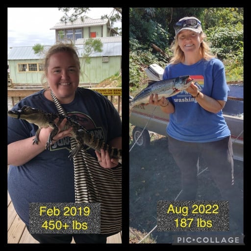 A before and after photo of a 5'4" female showing a weight reduction from 450 pounds to 187 pounds. A total loss of 263 pounds.