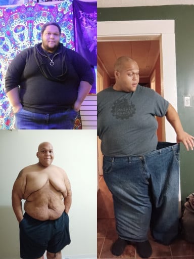 A progress pic of a 5'8" man showing a fat loss from 520 pounds to 365 pounds. A net loss of 155 pounds.