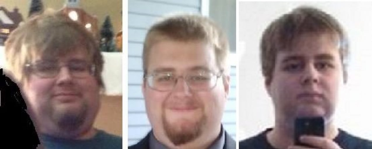 A picture of a 5'11" male showing a weight loss from 428 pounds to 290 pounds. A respectable loss of 138 pounds.