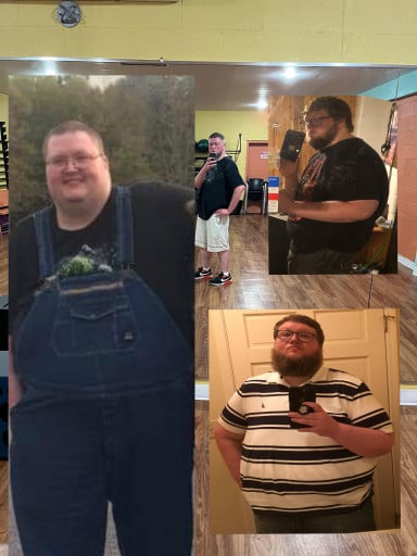 A before and after photo of a 5'11" male showing a weight reduction from 460 pounds to 285 pounds. A net loss of 175 pounds.