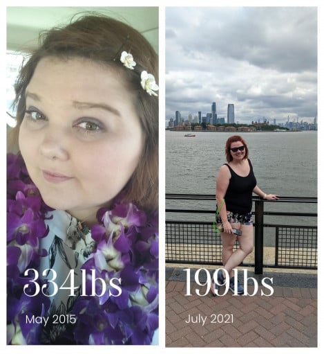 A picture of a 5'7" female showing a weight loss from 334 pounds to 199 pounds. A total loss of 135 pounds.