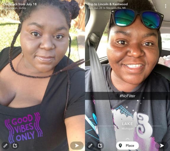 F/31/5'9 [348 Lbs > 310 Lbs = 38 Lbs] I Saw This Snapchat Memory and Noticed My Face Gains!