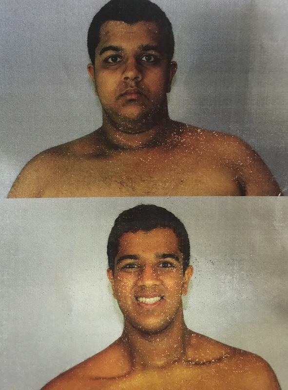 6 foot Male 113 lbs Fat Loss Before and After 354 lbs to 241 lbs