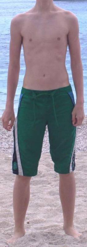 6 foot Male 70 lbs Muscle Gain 105 lbs to 175 lbs