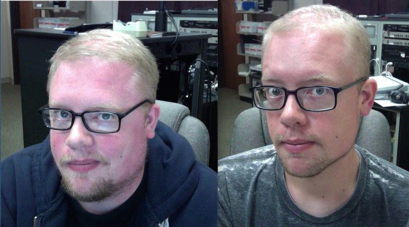 Progress Pics of 116 lbs Fat Loss 6 foot 3 Male 355 lbs to 239 lbs