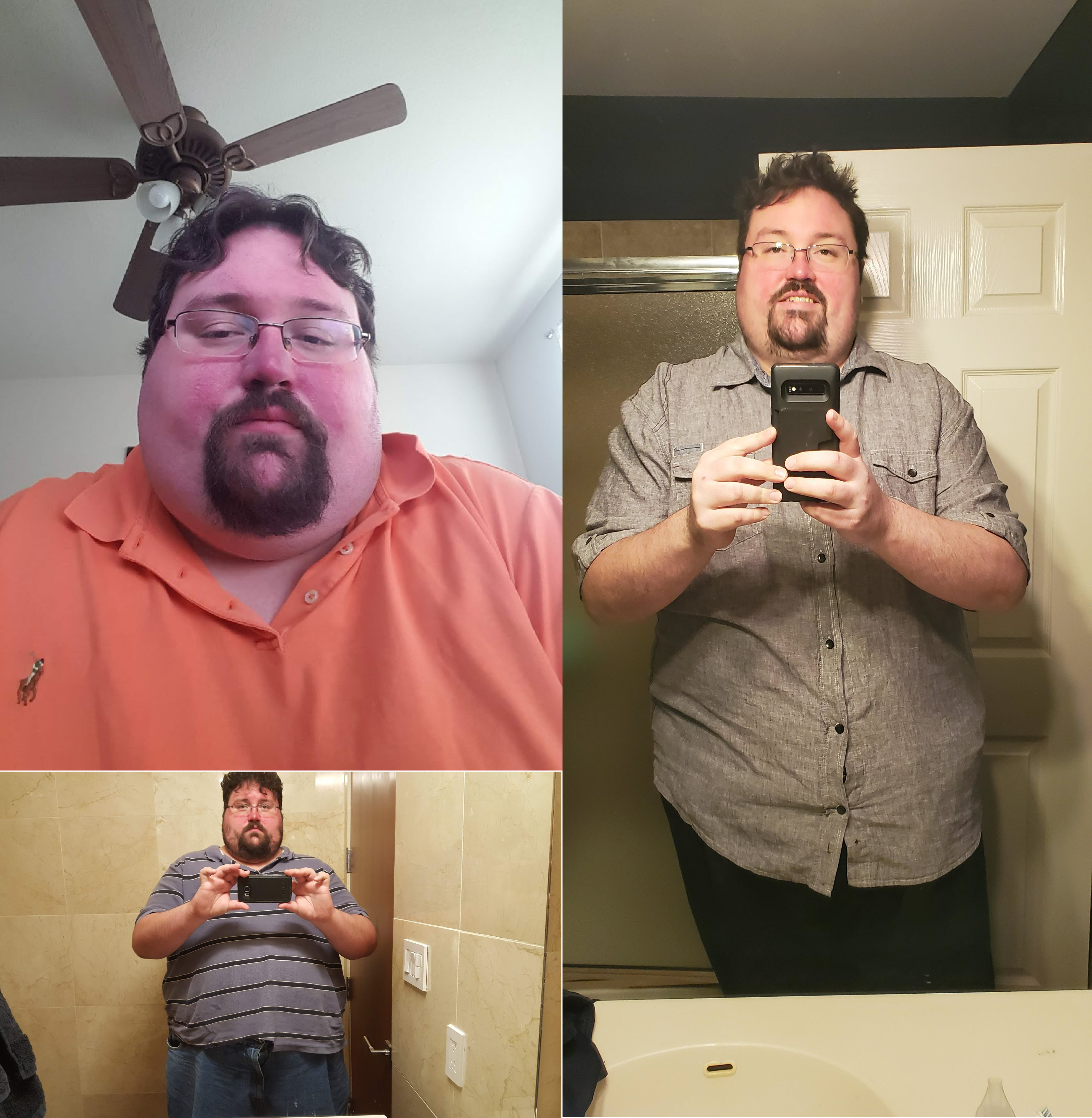 6 feet 3 Male 100 lbs Fat Loss Before and After 475 lbs to 375 lbs