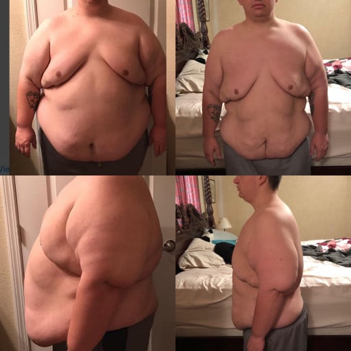 A before and after photo of a 5'7" male showing a weight reduction from 448 pounds to 300 pounds. A respectable loss of 148 pounds.