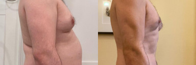 5 feet 11 Male Progress Pics of 27 lbs Fat Loss 215 lbs to 188 lbs
