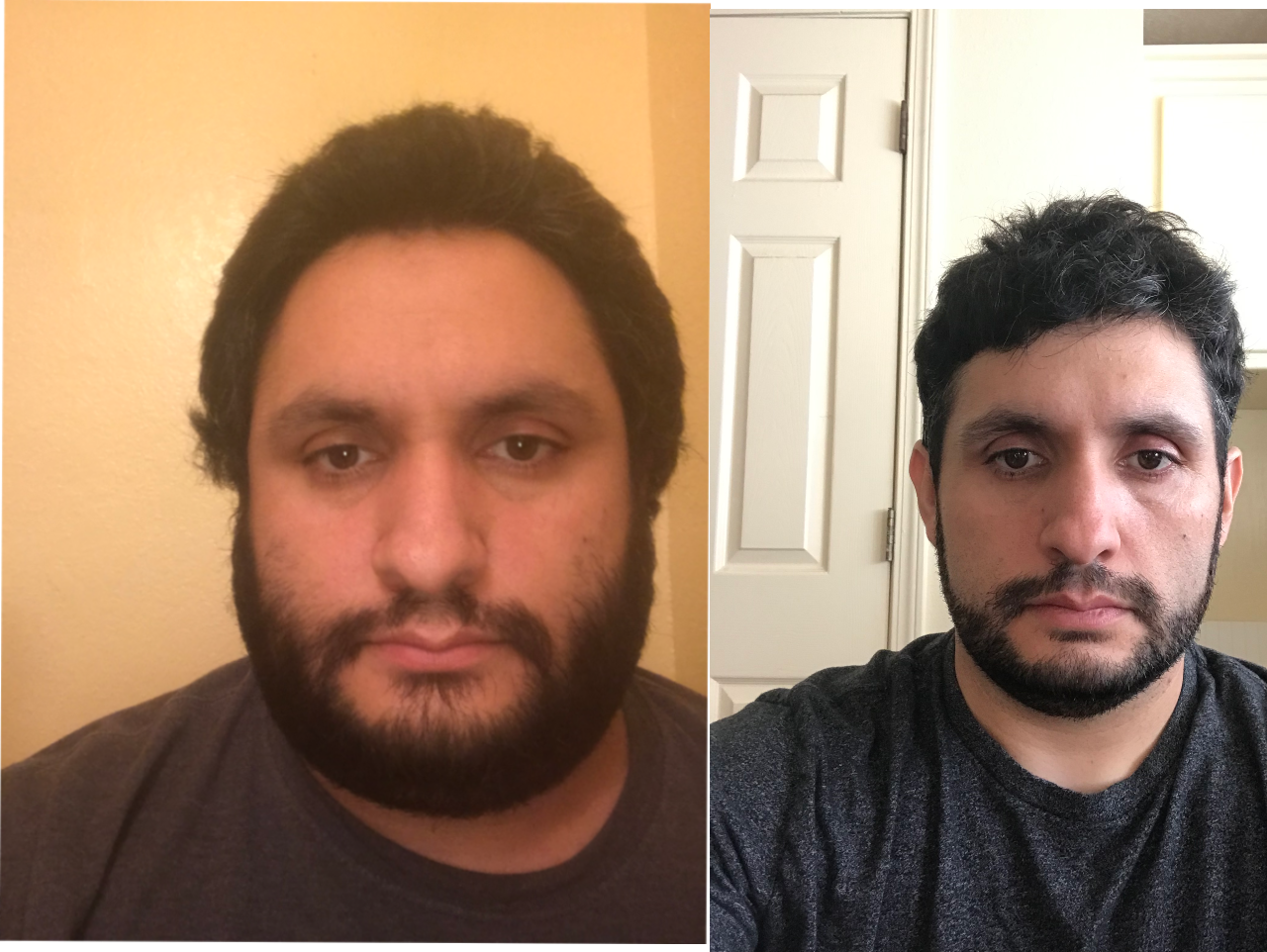 80 lbs Fat Loss 5 feet 6 Male 260 lbs to 180 lbs