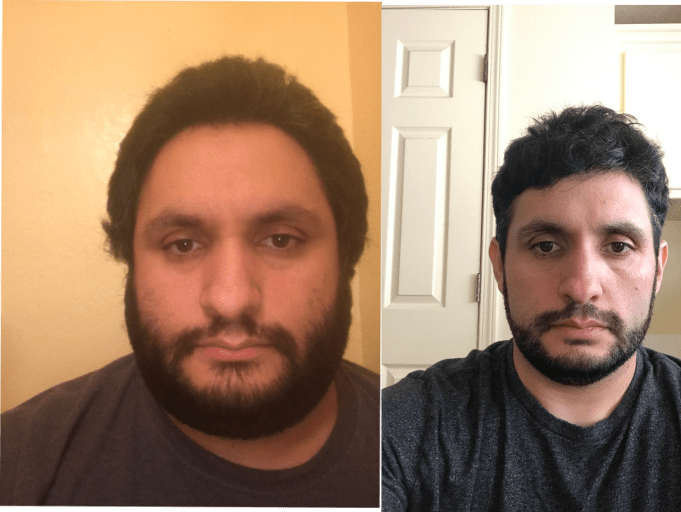 80 lbs Weight Loss Before and After 5 foot 6 Male 260 lbs to 180 lbs