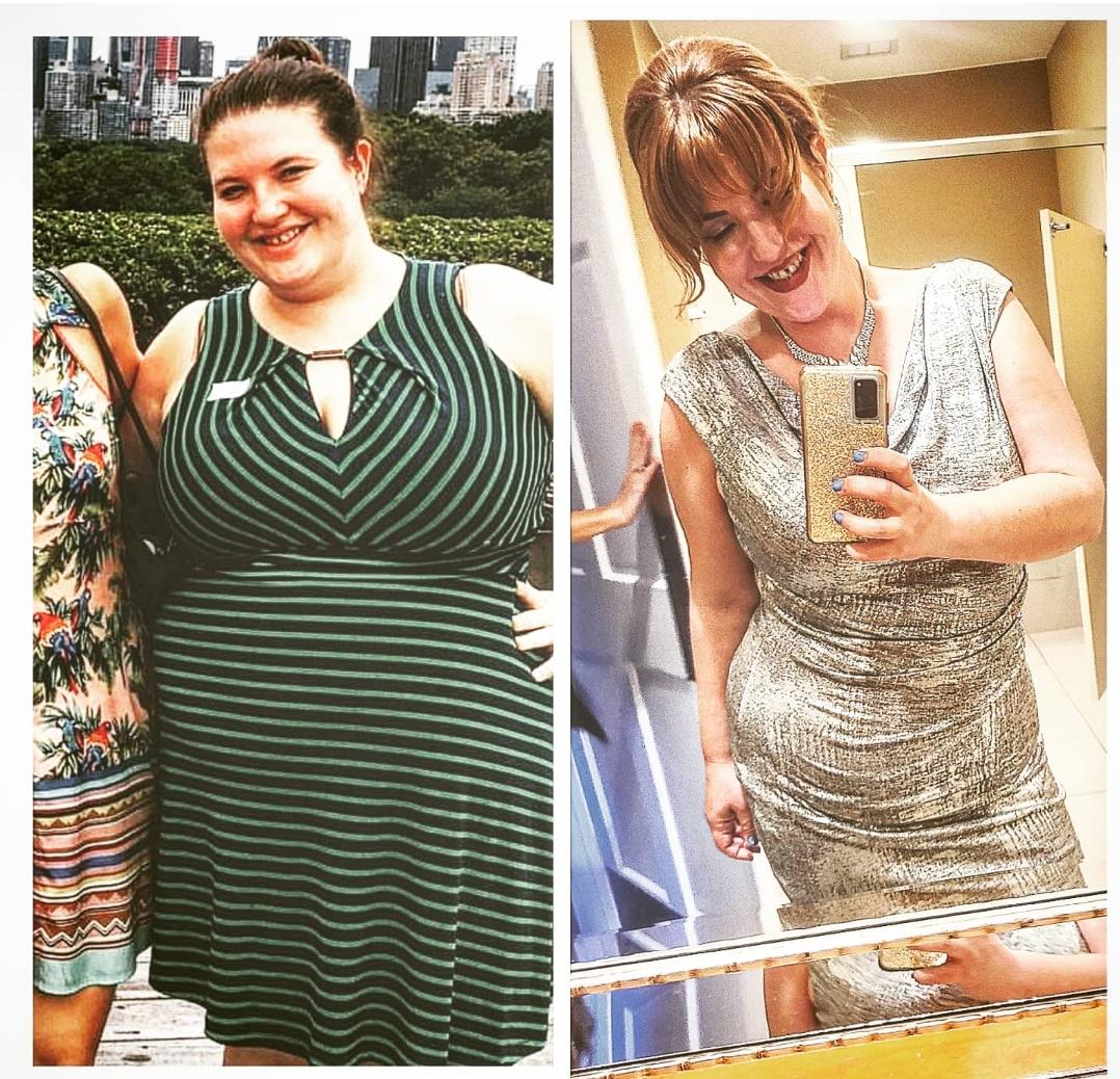 Before and After 77 lbs Fat Loss 5 foot 5 Female 258 lbs to 181 lbs