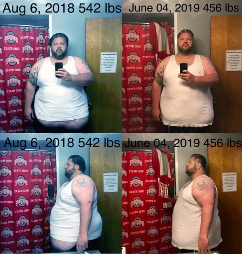6 foot 1 Male 86 lbs Fat Loss Before and After 542 lbs to 456 lbs