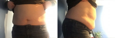 22 lbs Fat Loss Before and After 5 foot 2 Female 245 lbs to 223 lbs