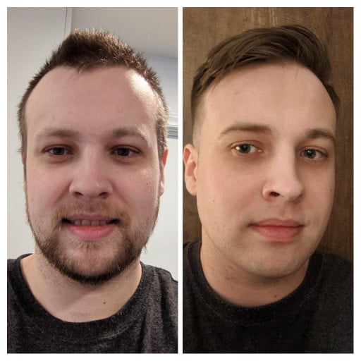 6 foot 1 Male 39 lbs Weight Loss Before and After 310 lbs to 271 lbs