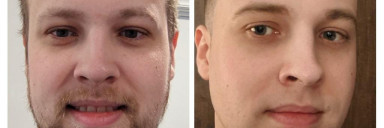 6 foot 1 Male 39 lbs Weight Loss Before and After 310 lbs to 271 lbs