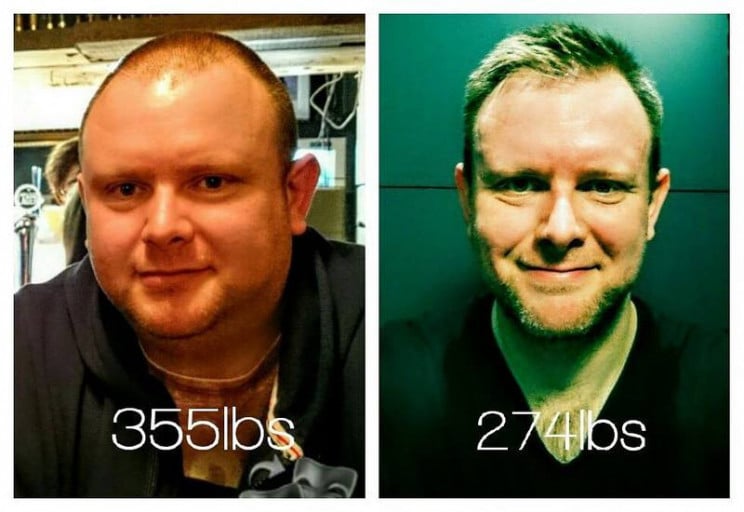 Progress Pics of 81 lbs Weight Loss 6 foot Male 355 lbs to 274 lbs