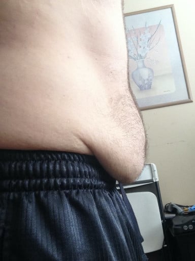 A picture of a 5'8" male showing a weight reduction from 285 pounds to 175 pounds. A net loss of 110 pounds.