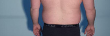 3 Pictures of a 5'10 258 lbs Male Weight Snapshot
