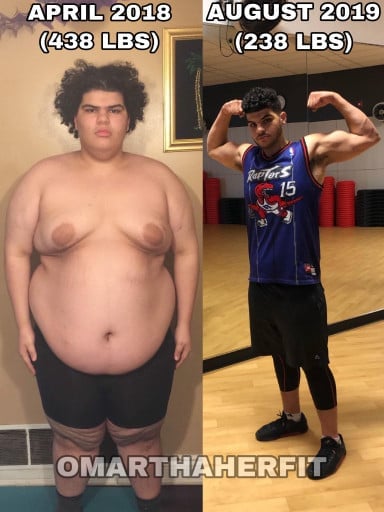 A before and after photo of a 6'2" male showing a weight reduction from 438 pounds to 238 pounds. A respectable loss of 200 pounds.