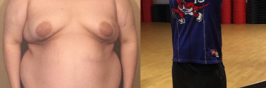 Before and After 200 lbs Weight Loss 6'2 Male 438 lbs to 238 lbs