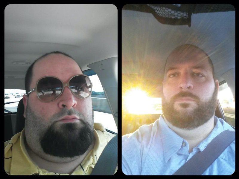 5'11 Male Before and After 97 lbs Fat Loss 500 lbs to 403 lbs