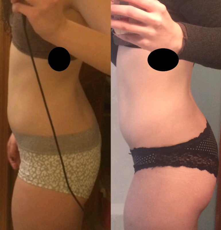 5 foot 10 Female Progress Pics of 15 lbs Weight Gain 140 lbs to 155 lbs