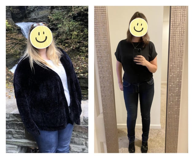 A before and after photo of a 5'9" female showing a weight reduction from 380 pounds to 190 pounds. A total loss of 190 pounds.