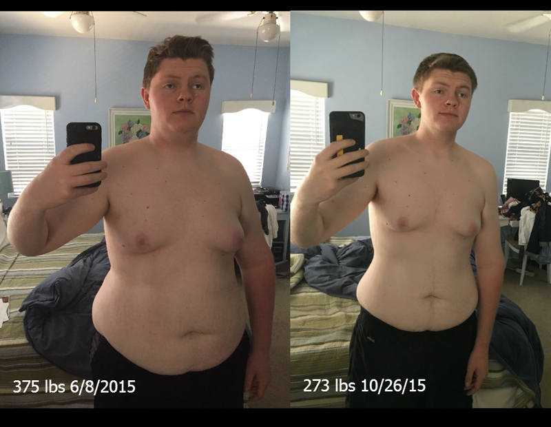 6'7 Male 102 lbs Weight Loss Before and After 375 lbs to 273 lbs