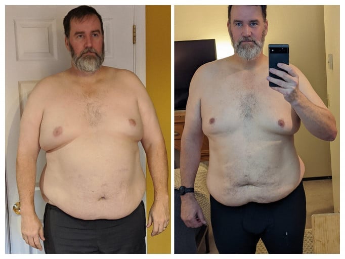 A before and after photo of a 6'3" male showing a weight reduction from 402 pounds to 298 pounds. A respectable loss of 104 pounds.