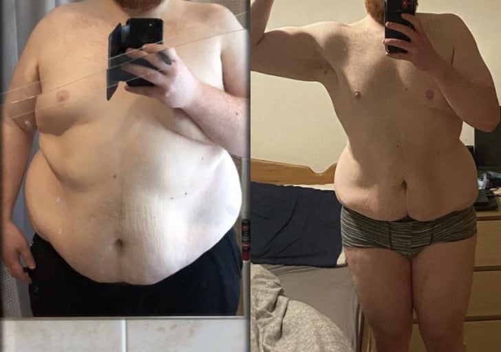 A before and after photo of a 6'3" male showing a weight reduction from 371 pounds to 260 pounds. A respectable loss of 111 pounds.