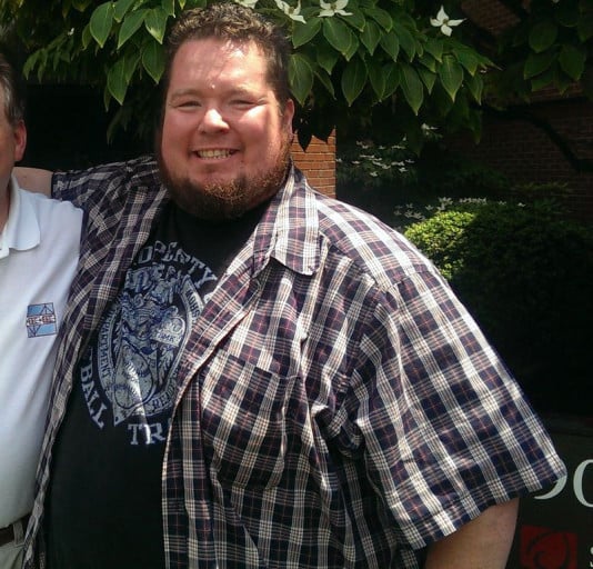 A before and after photo of a 5'9" male showing a weight loss from 390 pounds to 280 pounds. A net loss of 110 pounds.