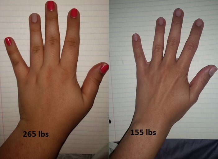 A picture of a 5'6" female showing a fat loss from 265 pounds to 155 pounds. A respectable loss of 110 pounds.