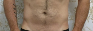 3 Pics of a 5'3 138 lbs Male Weight Snapshot