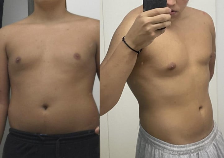 Teenager Loses 18Lbs in 5 Months: a Story of Dedication and Hard Work
