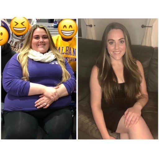 A before and after photo of a 5'2" female showing a weight reduction from 354 pounds to 165 pounds. A net loss of 189 pounds.