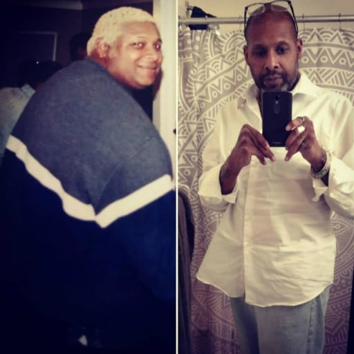 Before and After 200 lbs Fat Loss 6 foot Male 400 lbs to 200 lbs