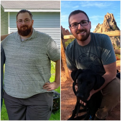 5 feet 11 Male 152 lbs Weight Loss Before and After 377 lbs to 225 lbs