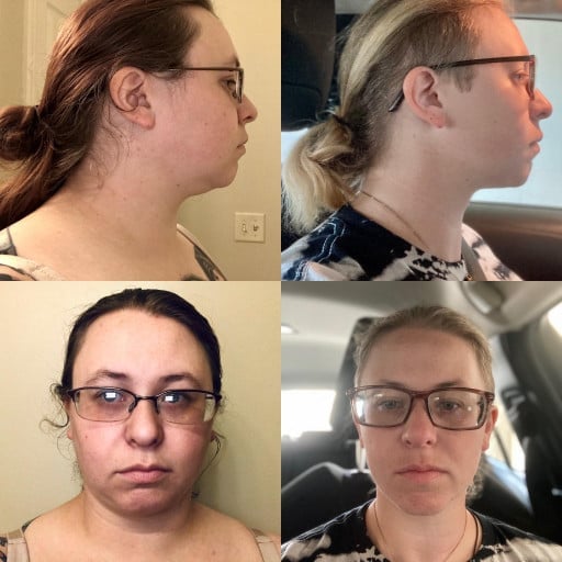 A progress pic of a 5'4" woman showing a fat loss from 264 pounds to 184 pounds. A net loss of 80 pounds.