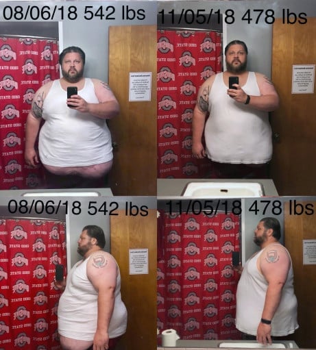Progress Pics of 65 lbs Fat Loss 6'1 Male 542 lbs to 477 lbs