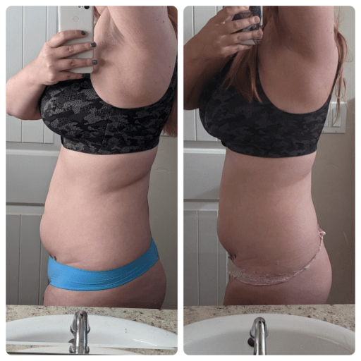 A before and after photo of a 5'10" female showing a weight reduction from 197 pounds to 189 pounds. A total loss of 8 pounds.