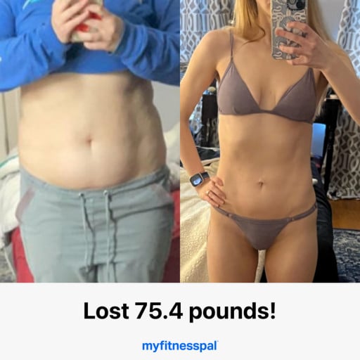 A before and after photo of a 5'5" female showing a weight reduction from 188 pounds to 113 pounds. A net loss of 75 pounds.