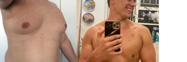 6 feet 1 Male 100 lbs Weight Loss Before and After 300 lbs to 200 lbs