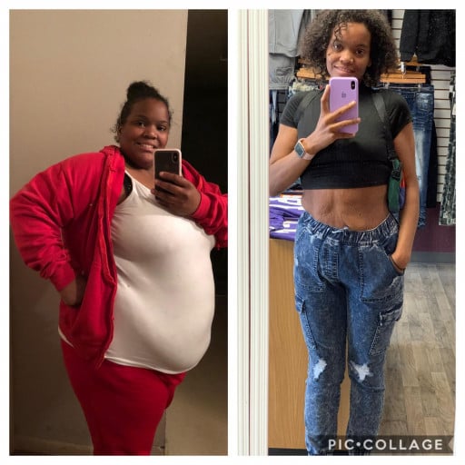 A before and after photo of a 5'6" female showing a weight reduction from 317 pounds to 140 pounds. A total loss of 177 pounds.