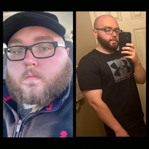 189 lbs Weight Loss Before and After 5 foot 9 Male 400 lbs to 211 lbs