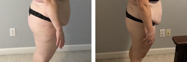 5 feet 5 Female 25 lbs Fat Loss Before and After 260 lbs to 235 lbs