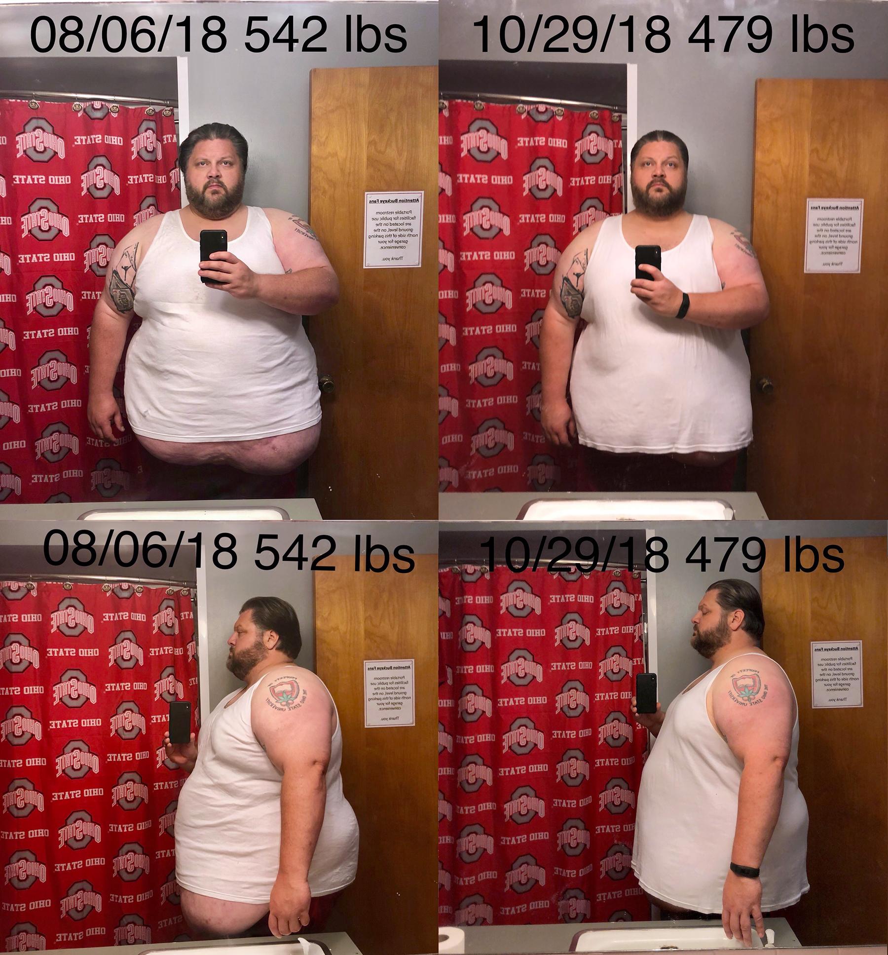 Before and After 63 lbs Fat Loss 6 foot 1 Male 542 lbs to 479 lbs