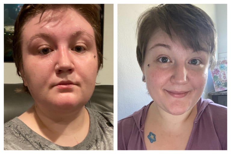 A 20Lb Weight Loss Journey in 3 Months: a Reddit User's Inspiring Story