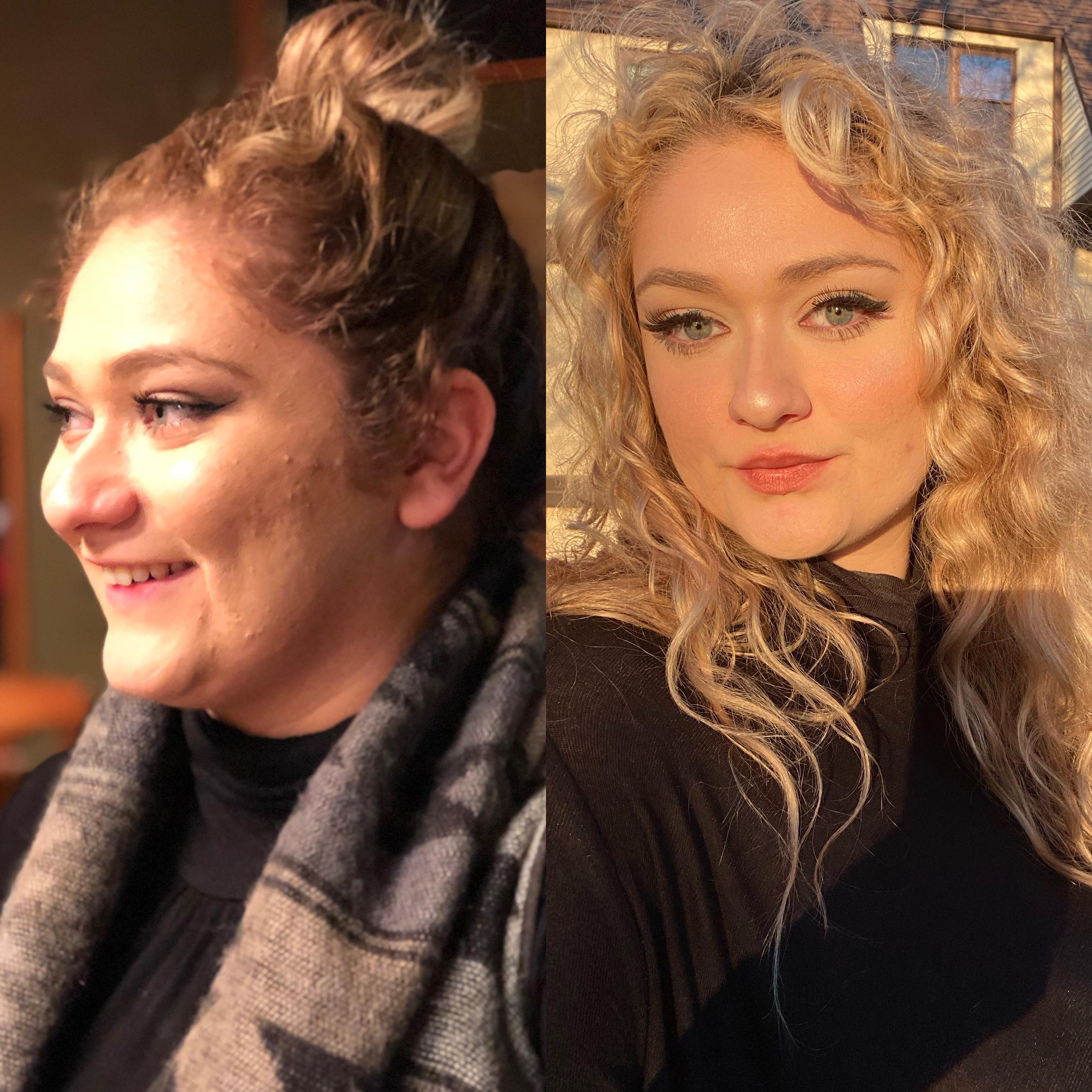 40 lbs Weight Loss 5 foot 8 Female 250 lbs to 210 lbs